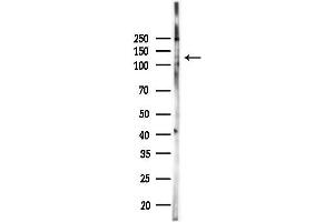 Western blot analysis of lysates from K562 cells(UV,30 min treatment), using Phospho-c-Kit (Tyr721) Antibody at 1/1000 dilution.