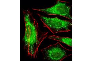 Fluorescent image of Hela cells stained with PPP2R2A Antibody (N-term).