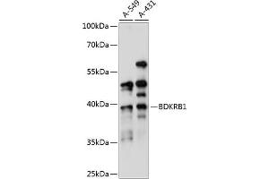 Western blot analysis of extracts of various cell lines, using BDKRB1 antibody (ABIN7265910) at 1:1000 dilution. (BDKRB1 抗体  (AA 1-100))