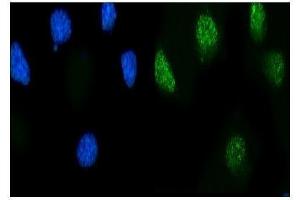 IF analysis of MSK2/RSK-B/RPS6KA4 using anti-MSK2/RSK-B/RPS6KA4 antibody (ABIN7601238).