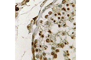 Immunohistochemical analysis of CIRBP staining in human testis formalin fixed paraffin embedded tissue section. (CIRBP 抗体)