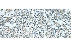 Immunohistochemistry of paraffin-embedded Human tonsil tissue using SHTN1 Polyclonal Antibody at dilution of 1:60(x200) (Shootin-1 (SHTN1) 抗体)