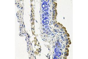Immunohistochemistry of paraffin-embedded mouse lung using MARK1 antibody at dilution of 1:100 (x40 lens). (MARK1 抗体)