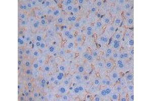 Used in DAB staining on fromalin fixed paraffin- embedded Kidney tissue (CD84 抗体  (AA 32-222))