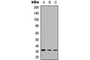 Western blot analysis of GCLM expression in SHSY5Y (A), HeLa (B), 3T3 (C) whole cell lysates. (GCLM 抗体  (Center))