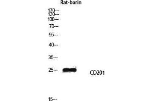 Western Blot (WB) analysis of Rat barin lysis using CD201 antibody. (PROCR 抗体  (Internal Region))