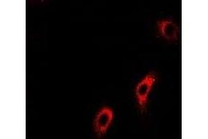 Immunofluorescent analysis of ACADS staining in U2OS cells.