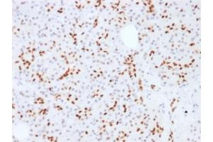 Immunohistochemistry (IHC) image for anti-SRY (Sex Determining Region Y)-Box 9 (SOX9) (AA 393-508) antibody (ABIN6940619)