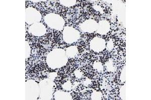 Immunohistochemical staining of human bone marrow with ZNF589 polyclonal antibody  shows strong nuclear positivity in bone marrow poietic cells. (ZNF589 抗体)