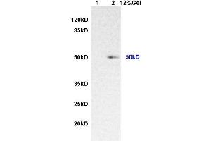 Lane 1: rat lung lysates Lane 2: human colon carcinomalysates probed with AntiIL-7Ra/CD127 Polyclonal Antibody, Unconjugated (ABIN731063) at 1:200 in 4 °C. (IL7R 抗体  (AA 251-350))