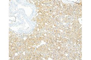 Immunohistochemistry (IHC) image for anti-Cadherin 5 (CDH5) (AA 25-595) antibody (ABIN7453992)