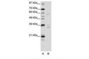 Image no. 1 for anti-Zinc Finger Protein 440 (ZNF440) (N-Term) antibody (ABIN203220) (ZNF440 抗体  (N-Term))