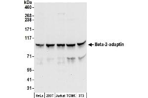 anti-Adaptor-Related Protein Complex 2, beta 1 Subunit (AP2B1) (AA 575-625) antibody