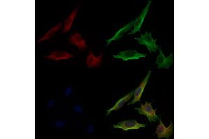 ABIN6264566 and ABIN6279733 staining 3 by IF/ICC. (RAB24 抗体  (Internal Region))