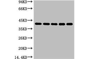 Western blot analysis of 1) 293T, 2) Hela, 3) HepG2, 4) Mouse Brain tissue, (EIF4A1 抗体)