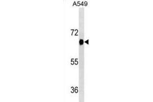 Western Blotting (WB) image for anti-Dual-Specificity tyrosine-(Y)-phosphorylation Regulated Kinase 2 (DYRK2) antibody (ABIN2995437) (DYRK2 抗体)