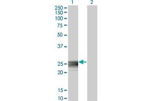 Western Blot analysis of RAB3B expression in transfected 293T cell line by RAB3B monoclonal antibody (M01A), clone 3F12. (RAB3B 抗体  (AA 120-219))