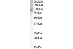 Image no. 1 for anti-phosphodiesterase 4B, cAMP-Specific (PDE4B) (C-Term) antibody (ABIN374649) (PDE4B 抗体  (C-Term))