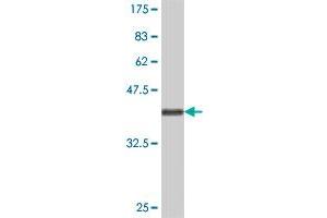 Western Blot detection against Immunogen (36. (TRIP6 抗体  (AA 51-148))