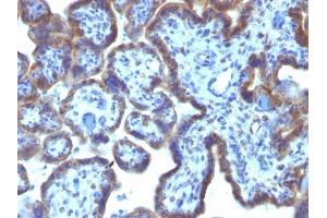 Immunohistochemistry (IHC) image for anti-Mastermind-Like 3 (MAML3) antibody (ABIN6940389)