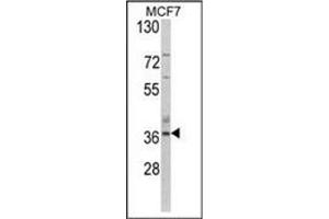 Image no. 1 for anti-Aspartoacylase (ASPA) (AA 89-118), (N-Term) antibody (ABIN452768) (ASPA 抗体  (N-Term))