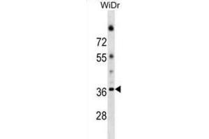 Western Blotting (WB) image for anti-Asparagine-Linked Glycosylation 5, Dolichyl-Phosphate beta-Glucosyltransferase Homolog (S. Cerevisiae) (ALG5) antibody (ABIN2999771) (ALG5 抗体)