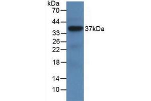 Western blot analysis of recombinant Human LRG1. (LRG1 抗体  (AA 37-340))