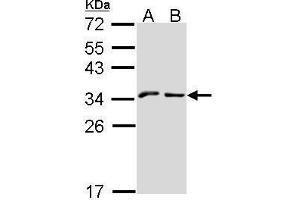 WB Image Sample (30 ug of whole cell lysate) A: A431 , B: Hep G2 , 12% SDS PAGE NKG2-A (CD159a) antibody antibody diluted at 1:1000 (KLRC1 抗体  (N-Term))