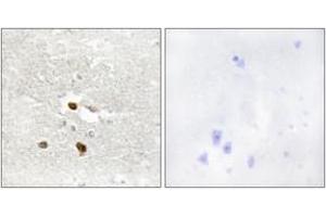 Immunohistochemistry analysis of paraffin-embedded human brain tissue, using ZNF287 Antibody. (ZNF287 抗体  (AA 241-290))