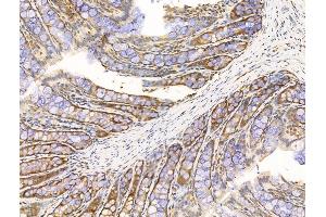 ABIN6264629 and ABIN6268914 at 1/100 staining Rat colorectal tissue by IHC-P.