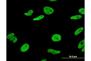 Immunofluorescence of monoclonal antibody to HNRNPA1 on HeLa cell. (HNRNPA1 抗体  (AA 1-320))