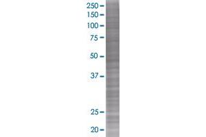 MMP8 transfected lysate (MMP8 293T Cell Transient Overexpression Lysate(Denatured))