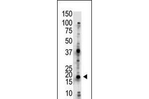 Antibody is used in Western blot to detect UBE2G2 in Jurkat cell lysate. (UBE2G2 抗体  (N-Term))