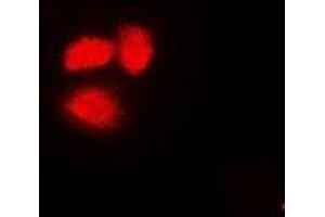 Immunofluorescent analysis of Exportin 5 staining in A549 cells. (XPO5 抗体)