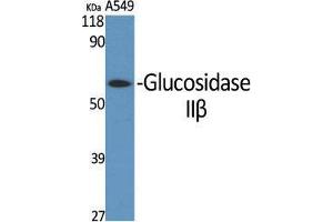 Western Blot (WB) analysis of specific cells using Glucosidase IIbeta Polyclonal Antibody. (GBA2 抗体  (Internal Region))