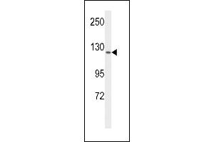 Western blot analysis of VGFR1 Antibody (ABIN653260 and ABIN2842780) in MCF-7 cell line lysates (35 μg/lane). (FLT1 抗体)
