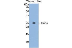 Western Blotting (WB) image for anti-Osteoclast Stimulating Factor 1 (OSTF1) (AA 10-215) antibody (ABIN1860107) (OSTF1 抗体  (AA 10-215))