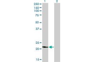Western Blot analysis of VSNL1 expression in transfected 293T cell line by VSNL1 monoclonal antibody (M01), clone 2F1-E3.