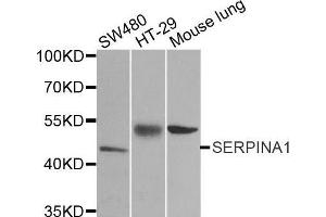 Western Blotting (WB) image for anti-serpin Peptidase Inhibitor, Clade A (Alpha-1 Antiproteinase, Antitrypsin), Member 1 (SERPINA1) (AA 25-315) antibody (ABIN3021276)