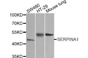 Western blot analysis of extracts of various cell lines, using SERPINA1 antibody. (SERPINA1 抗体  (AA 25-315))