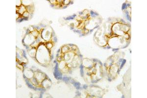 Anti-P cadherin antibody, IHC(P) IHC(P): Human Placenta Tissue (P-Cadherin 抗体  (Middle Region))