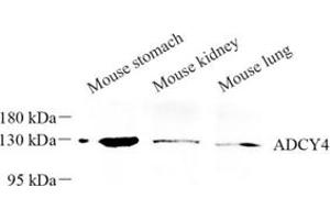 Western blot analysis of ADCY4 (ABIN7072959) at dilution of 1: 250 (ADCY4 抗体)