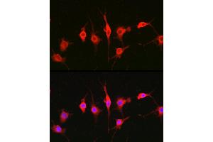 Immunofluorescence analysis of BALB-3T3 cells using Heparanase 1 Rabbit pAb (ABIN6128033, ABIN6141977, ABIN6141978 and ABIN6221391) at dilution of 1:100 (40x lens). (HPSE 抗体  (AA 36-275))