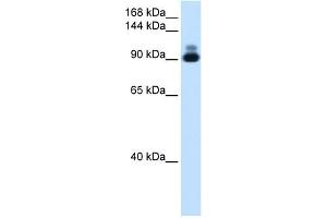 RSRC2 antibody used at 2. (RSRC2 抗体  (C-Term))