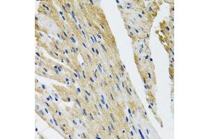 Immunohistochemistry of paraffin-embedded mouse heart using COPB2 antibody. (COPB2 抗体  (AA 657-906))