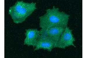 ICC/IF analysis of BHMT in Hep3B cells line, stained with DAPI (Blue) for nucleus staining and monoclonal anti-human BHMT antibody (1:100) with goat anti-mouse IgG-Alexa fluor 488 conjugate (Green). (BHMT 抗体)