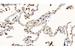 Detection of PGLYRP1 in Human Lung Tissue using Polyclonal Antibody to Peptidoglycan Recognition Protein 1 (PGLYRP1) (PGLYRP1 抗体  (AA 22-196))