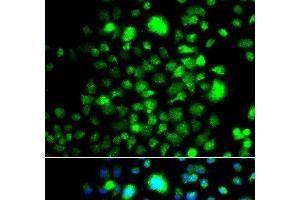 Immunofluorescence analysis of A549 cells using PEX14 Polyclonal Antibody (PEX14 抗体)