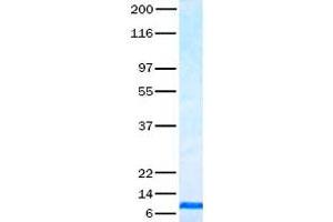 Validation with Western Blot (CCL4 蛋白)