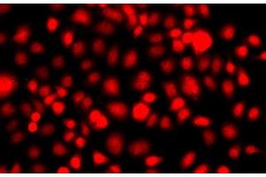 Immunofluorescence analysis of A549 cells using NR2E1 Polyclonal Antibody (NR2E1 抗体)